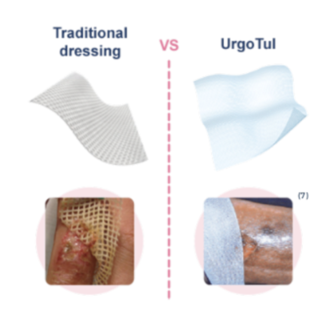 UrgoTul TLC healing matrix for wounds