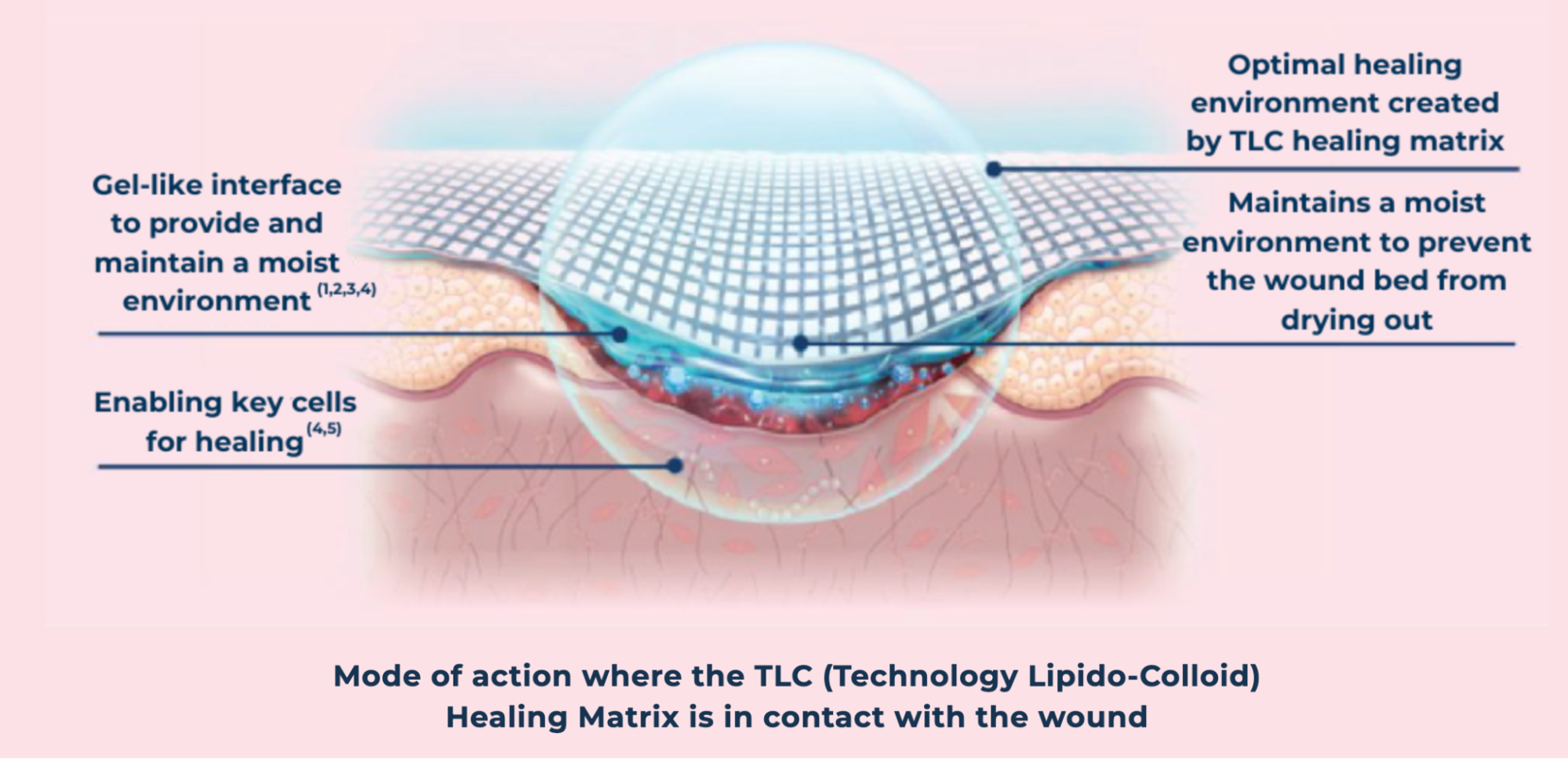 Technology Lipido-Colloid healing matrix dressing on wound